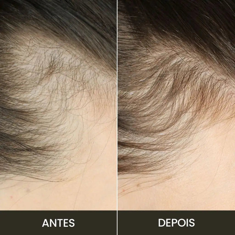 Escova de Terapia Capilar: Hair Care e Wellness para Cabelos Saudáveis - Tá na Mão